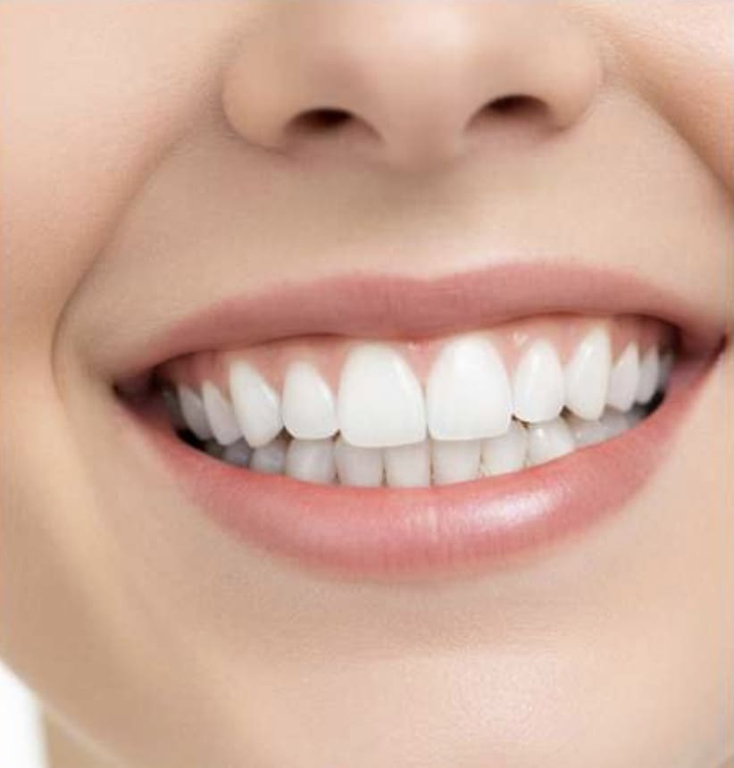 45 Minutes Whitening Treatment - Smart Deal